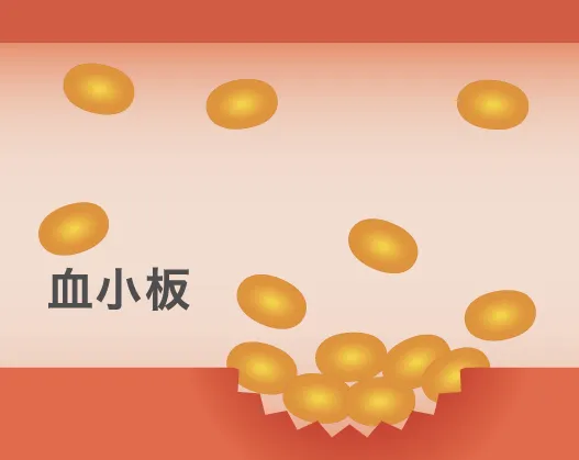 止血の仕組み：血小板が集まる