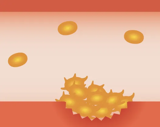 止血の仕組み：血管壁に粘着