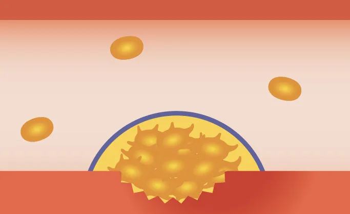 止血の仕組み：二次止血