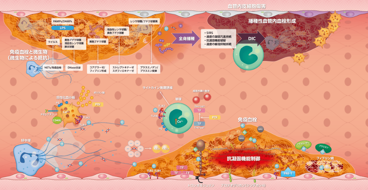 図2 免疫血栓形成とDIC