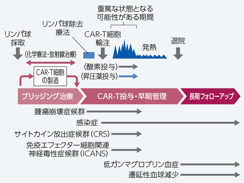 CAR-T細胞療法の一般的な経過