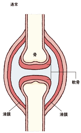 通常