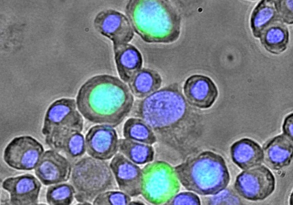 BKポリオーマウイルス感染細胞の免疫蛍光染色像
