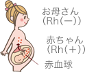 抗D人免疫グロブリン製剤の作用1