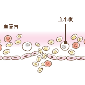 血が止まる仕組み：出血